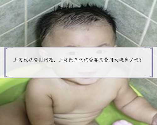 上海代孕费用问题，上海做三代试管婴儿费用大概多少钱？